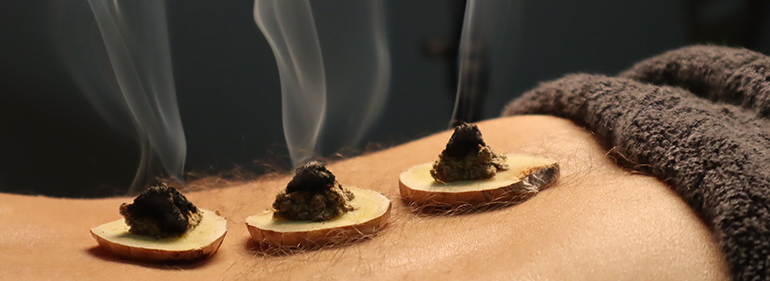 Moxibustion Health Treatment